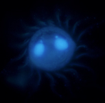 Image of a DAPI-stained Lugol's fixed cell