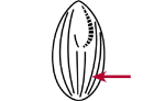 Somatic kinety