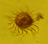 Image of a Lugol's fixed cell